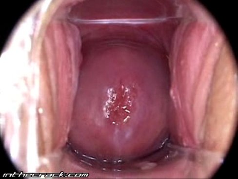 Camera Inside Grool Vagina