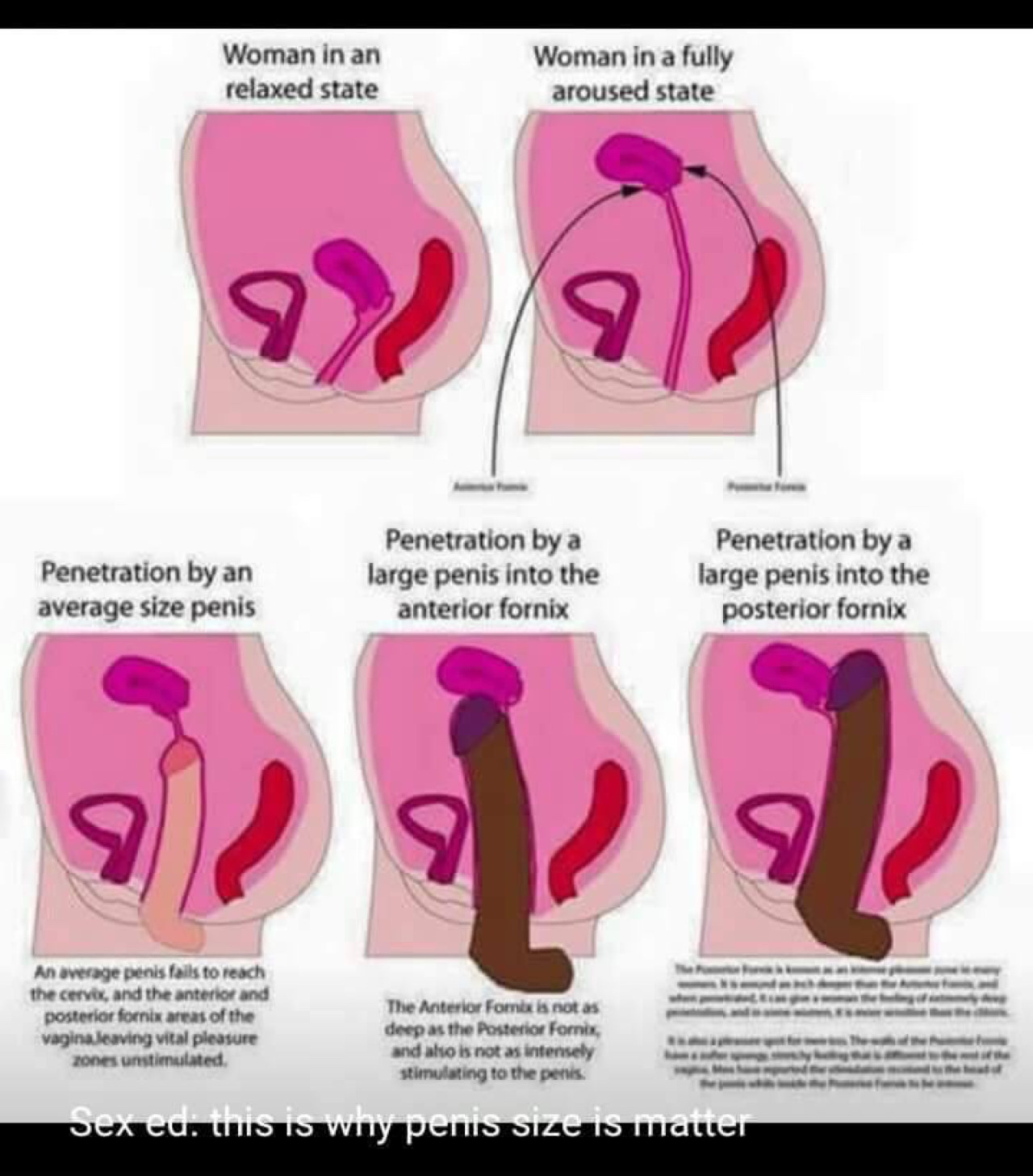 Cock cervix